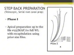 Step Back Preparation