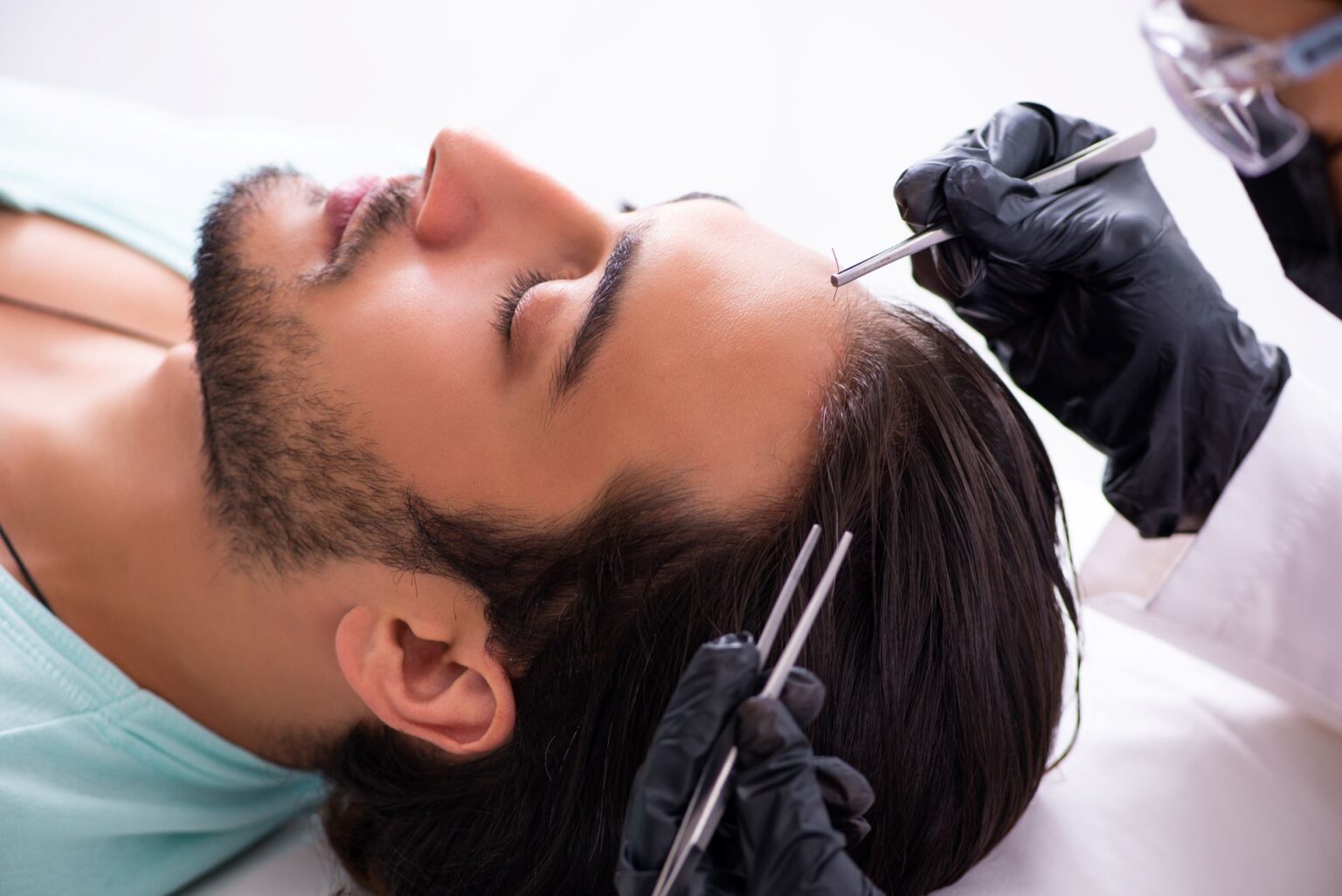 The Journey From Hair Loss To Transplant