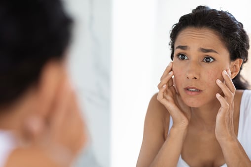 What To Do About Dark Spots Developing On Your Face