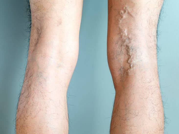 Behind The Scenes: The Work Of Vein Doctors