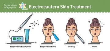 Skin Tags