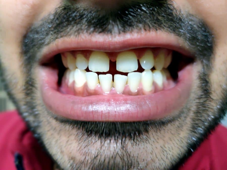 4 Best Ways To Keep Your Teeth In Perfect Health