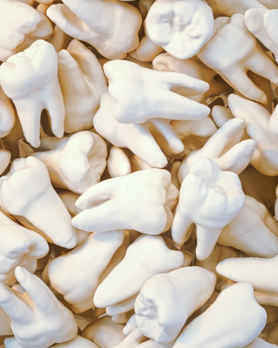 What Does A Tooth Cavity Look Like