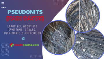 Pseudonits - Healthsoothe