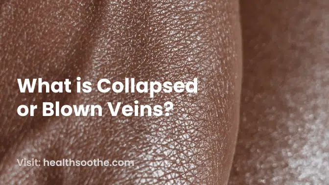 The Power Of Precision: Spotlight On Our Vein Specialist